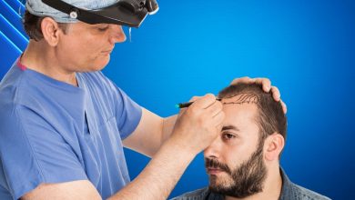 Patient getting hair line drawn for hair transplant procedure