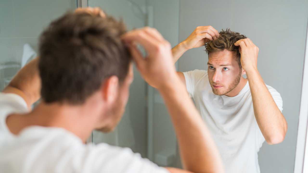 guy facing Hair Loss